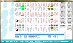 Eaglesoft Dental Charting